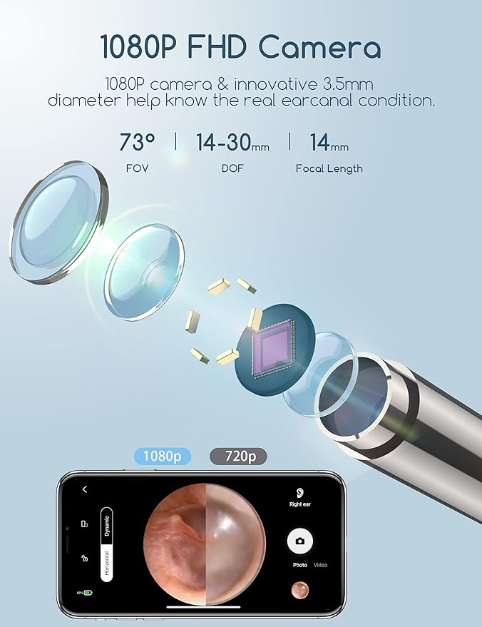 7MD Ear Cleaner Portable Visual Wifi Ear Wax Cleaner Endoscope With Rechargeable Battery | MX8 |