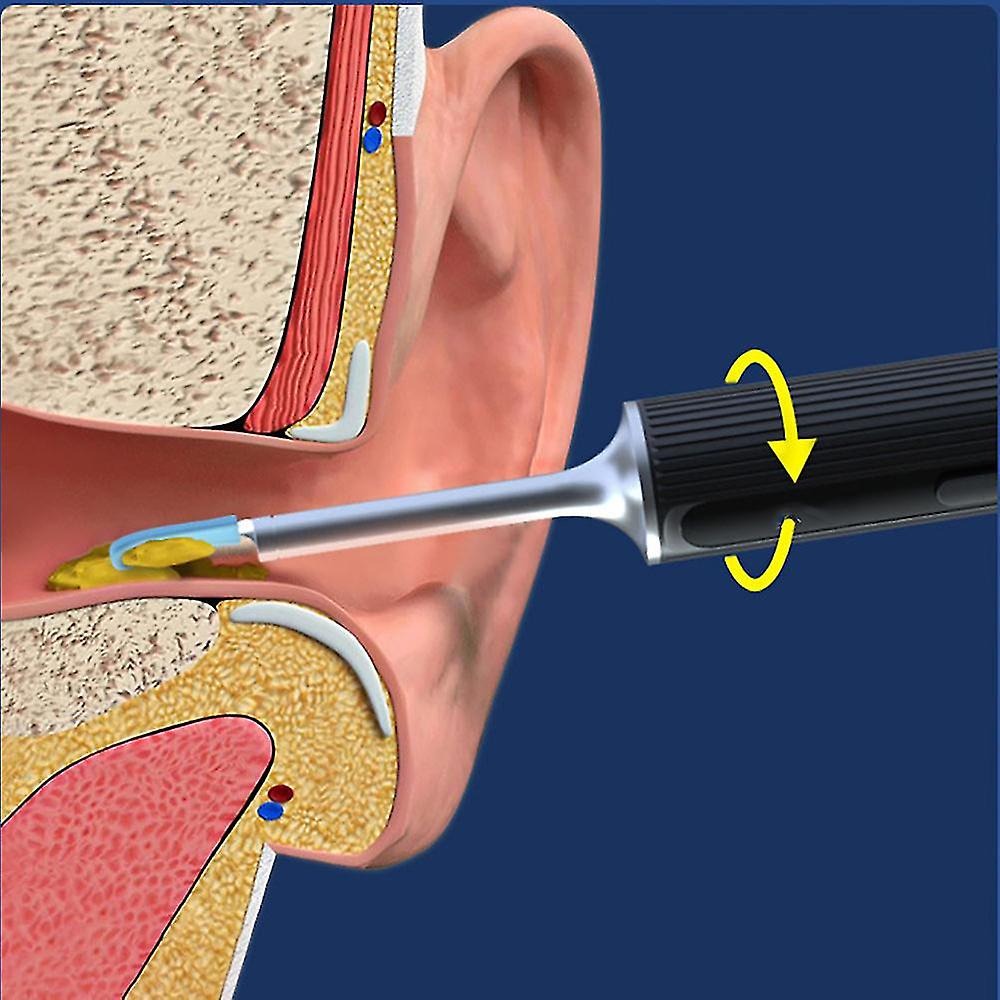 7MD Ear Cleaner Portable Visual Wifi Ear Wax Cleaner Endoscope With Rechargeable Battery | MX8 |