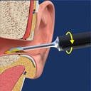 7MD Ear Cleaner Portable Visual Wifi Ear Wax Cleaner Endoscope With Rechargeable Battery | MX8 |