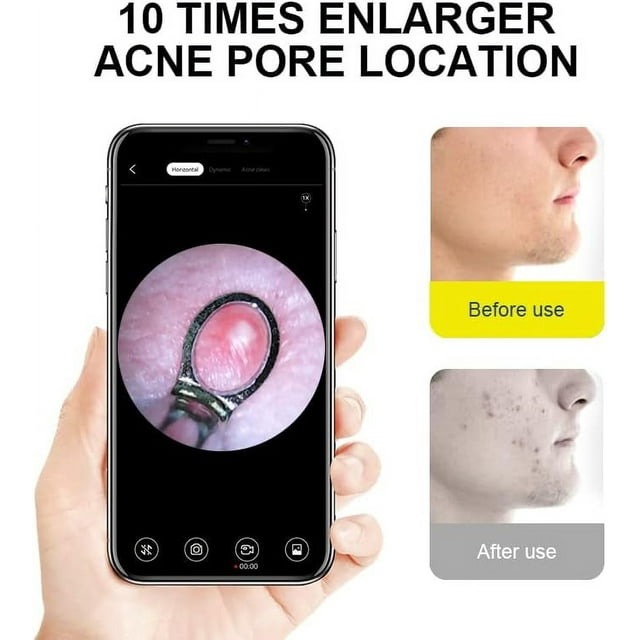 7MD Ear Cleaner Portable Visual Wifi Ear Wax Cleaner Endoscope With Rechargeable Battery | MX8 |
