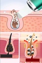 7md Facial Cleaning Ultrasonic Skin Scrubber Deep Face Cleaning Device | 7MD2410 |